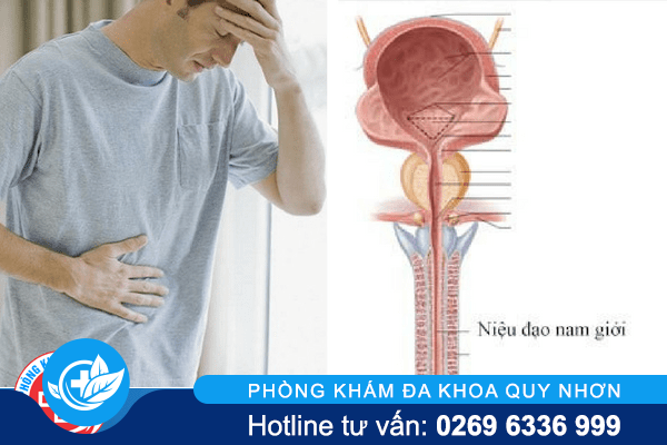 Các dấu hiệu viêm niệu đạo mà bạn cần phải chú ý