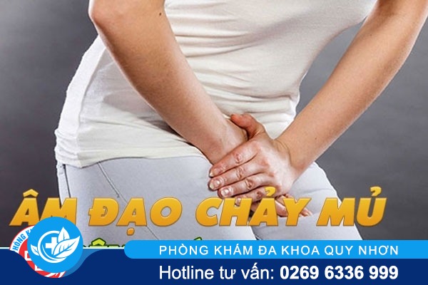 Âm đạo chảy mủ, dấu hiệu mắc bệnh nguy hiểm