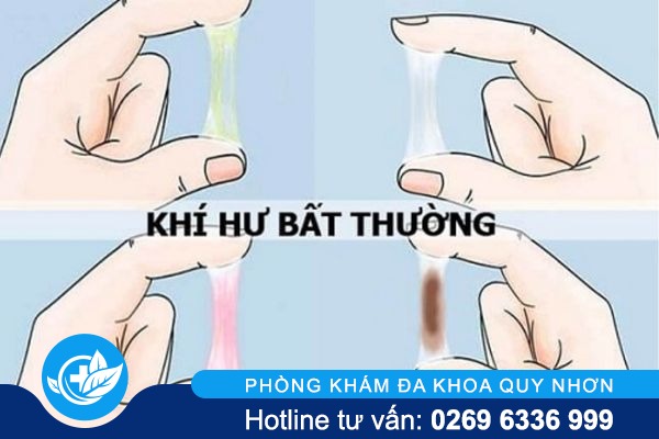 benh-huyet-trang-nguy-hiem-nhu-the-nao-02