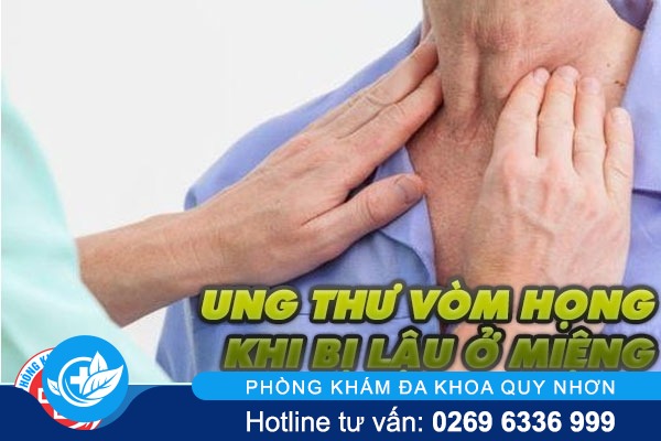 Mắc bệnh lậu ở miệng có nguy cơ ung thư vòm họng cao