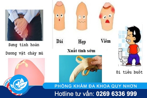 benh-nam-khoa-hay-gap-la-gi