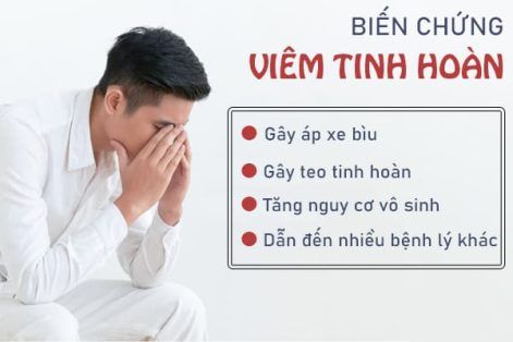 Những biện pháp hỗ trợ điều trị viêm tinh hoàn tốt hiện nay