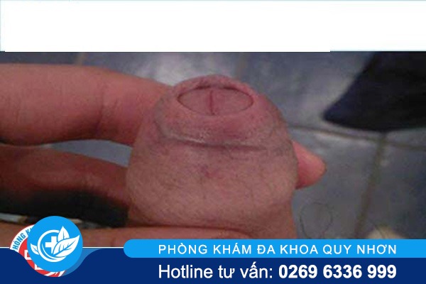 cach-lot-bao-quy-dau-tai-nha-1-(1)(2)