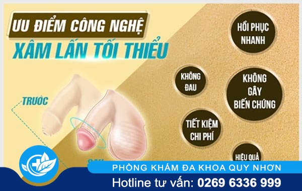 cắt bao quy đầu xâm lấn tối thiểu