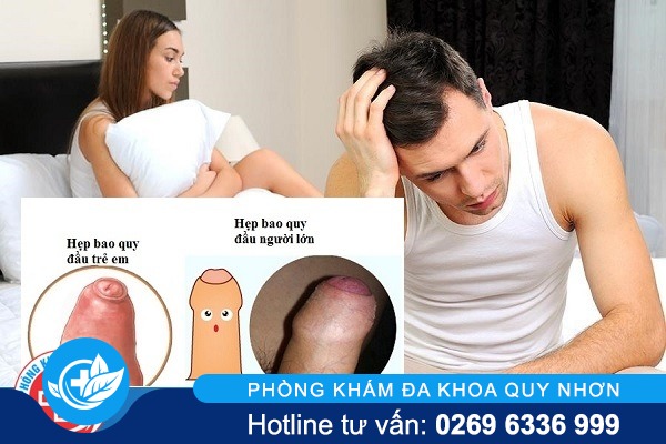 chua-hep-bao-quy-dau