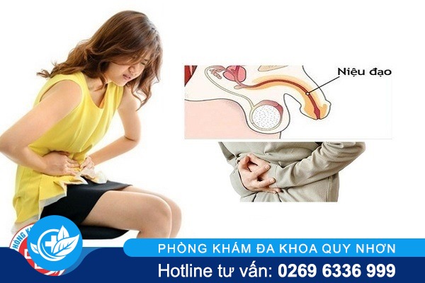 Các giải pháp hỗ trợ chữa viêm niệu đạo hiệu quả