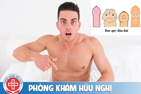 Bạn có biết dài bao quy đầu và nam giới có nên cắt bao quy đầu bị dài không?