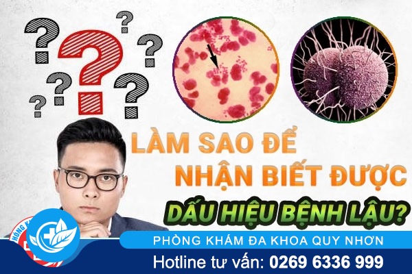 Cách nhận biết dấu hiệu bệnh lậu ở nam và nữ giới