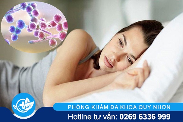Nấm Candida – nguyên nhân gây nhiều bệnh lý nguy hiểm