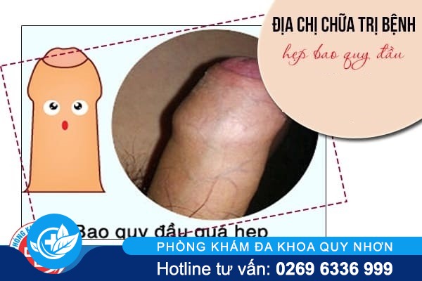 DIA-CHI-CHUA-HEP-BAO-QUY-DAU