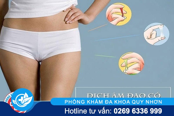 Chị em cần chú ý dấu hiệu dịch âm đạo có màu bất thường
