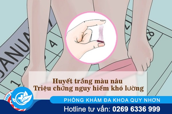 Huyết trắng màu nâu nguy hiểm như thế nào?