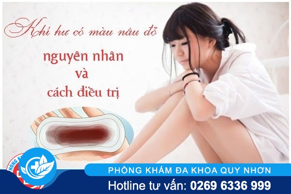 Bạn có nguy cơ mắc bệnh phụ khoa nguy hiểm khi có khí hư màu đỏ