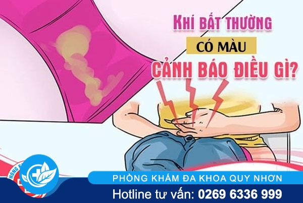 Biểu hiện khí hư có màu là bệnh gì ?