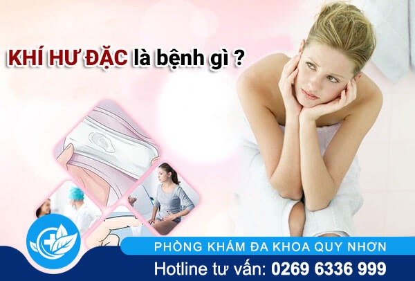 Khí hư đặc là biểu hiện bệnh gì ở nữ giới?