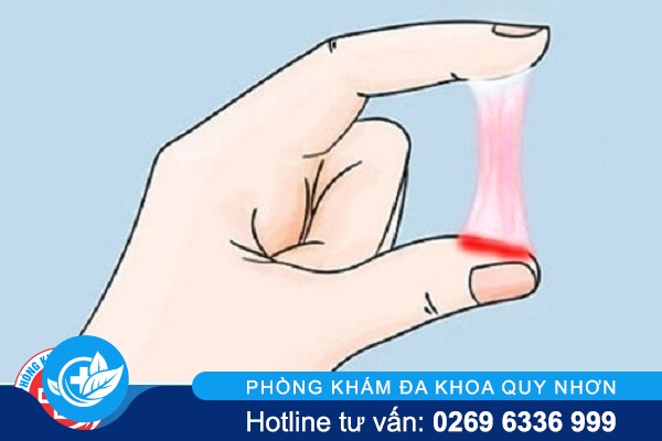 khí hư màu hồng