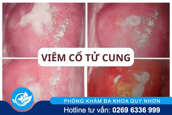 khi-hu-mau-trang-co-nguy-hiem-khong-01