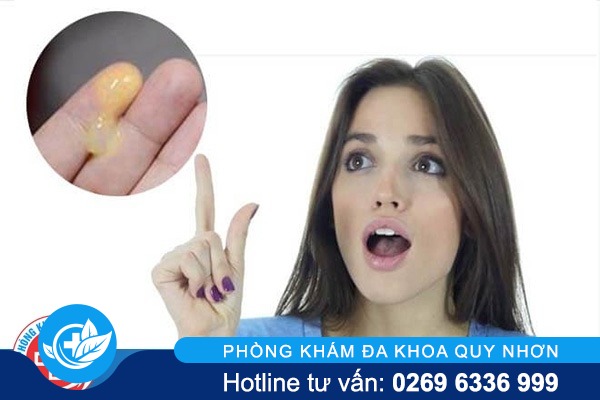 Khí hư màu vàng và những điều cần biết