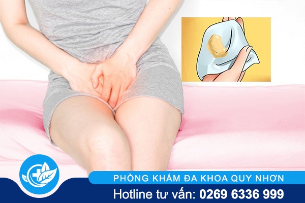 Khí hư ra nhiều có màu vàng – Nguyên nhân và cách hỗ trợ điều trị ra sao?