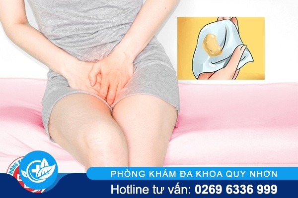 Mối nguy hiểm của khí hư màu vàng đối với nữ giới