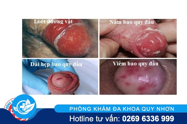 ngua-bao-quy-dau-nguyen-nhan