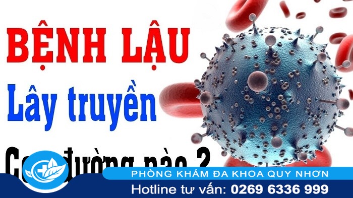 Những nguyên nhân bệnh lậu đơn giản mà bạn không thể ngờ tới