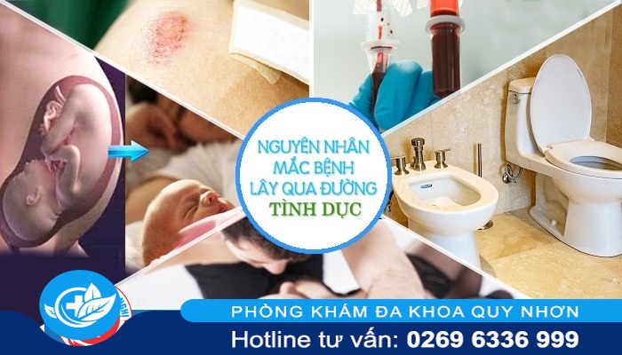 bệnh lậu ở nữ