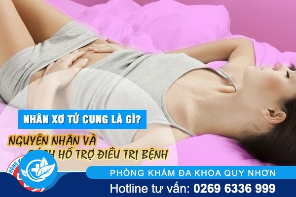 Những điều cần biết về bệnh nhân xơ tử cung ở nữ giới