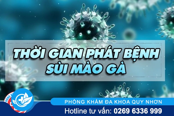 Thời gian phát bệnh sùi mào gà trong bao lâu