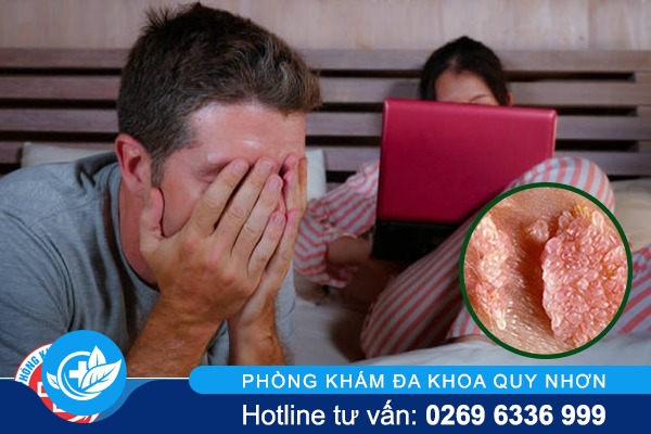 Sùi mào gà có liên quan gì đến ung thư?