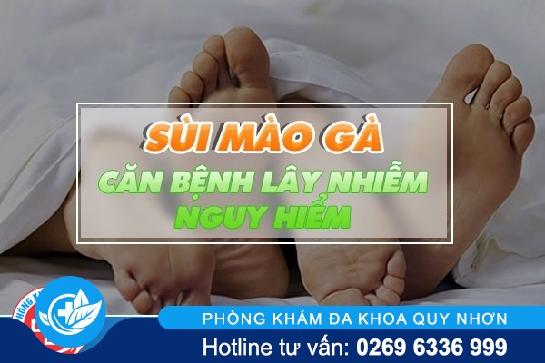 Cùng tìm hiểu rõ về bệnh sùi mào gà