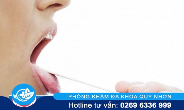 Cách nhận biết bệnh sùi mào gà ở lưỡi