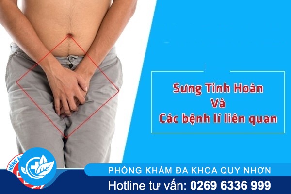 Hiện tượng sưng tinh hoàn và các kiến thức cần biết
