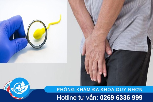 Tinh trùng màu vàng và các biến chứng nguy hiểm