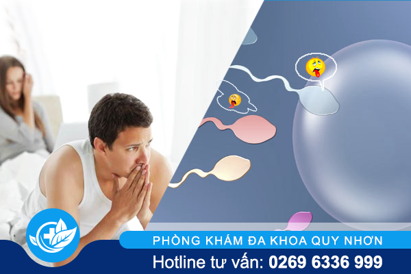 Phương pháp hỗ trợ điều trị tinh trùng yếu của các bác sĩ chuyên khoa