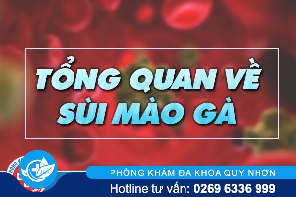 Bệnh sùi mào gà nguy cơ mắc bệnh xã hội nguy hiểm