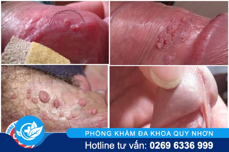 triue-chung-sui-mao-ga-nam