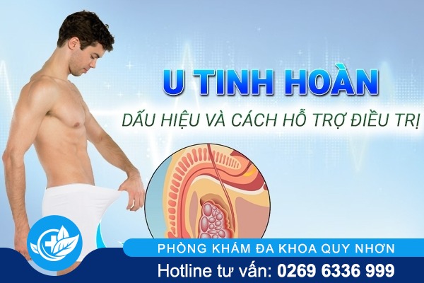 U tinh hoàn – Căn bệnh mà nam giới cần phải đề phòng