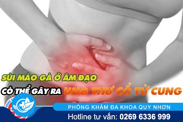 Sùi mào gà ở âm đạo có thể gây ung thư cổ tử cung