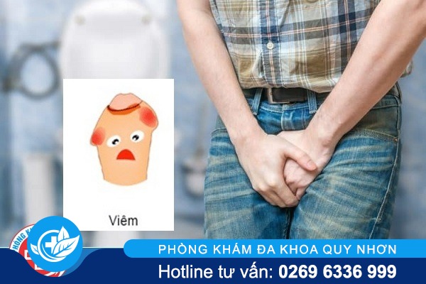 Hãy cẩn thận với bệnh viêm bao quy đầu ở nam giới