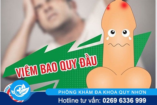 Hiện tượng viêm bao quy đầu ở nam giới là gì?
