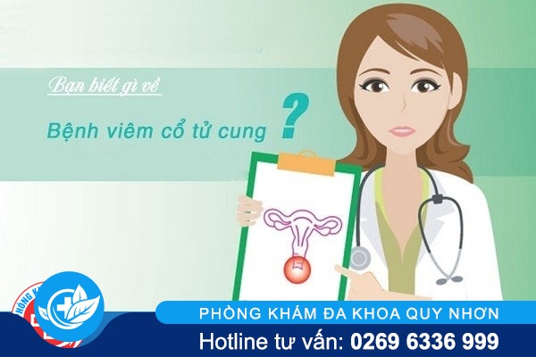 Bệnh viêm cổ tử cung và những điều cần biết