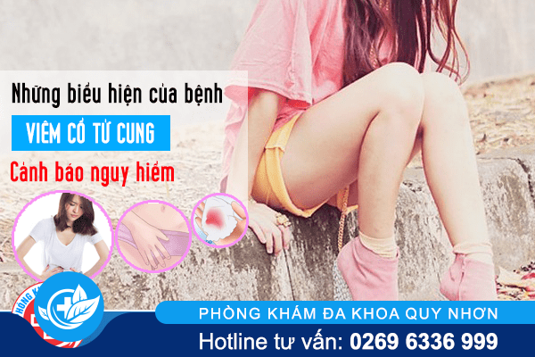 Cẩn thận với các triệu chứng của bệnh viêm cổ tử cung