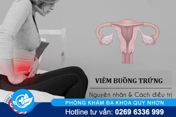 Nguyên nhân gây viêm buồng trứng ở nữ giới là gì?