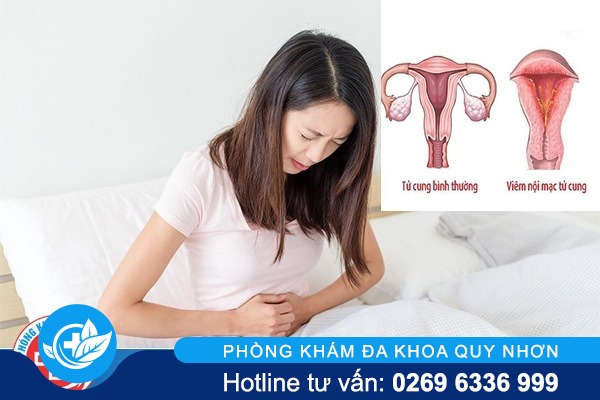 Viêm nội mạc tử cung – Nguyên nhân và cách hỗ trợ điều trị hiệu quả