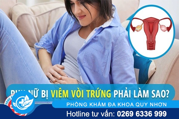 Hỗ trợ điều trị viêm vòi trứng ở nữ giới như thế nào hiệu quả?