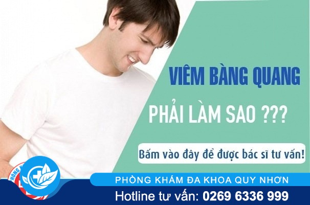 Bệnh viêm bàng quang và những kiến thức cần biết
