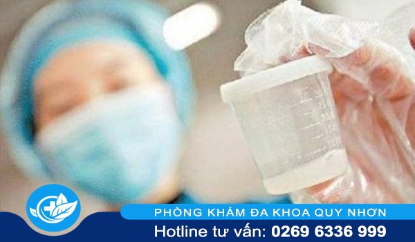 Địa chỉ phòng khám chuyên xét nghiệm tinh trùng uy tín tại Quy Nhơn