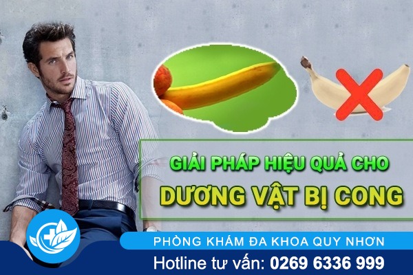 Cách xử lý hiệu quả dương vật bị cong vẹo