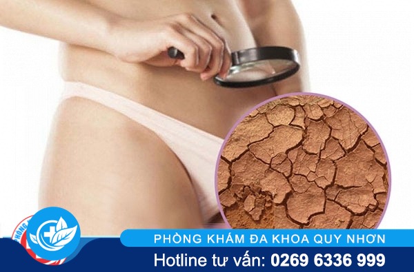 Triệu chứng khô âm đạo tiềm ẩn những nguy hiểm nào?